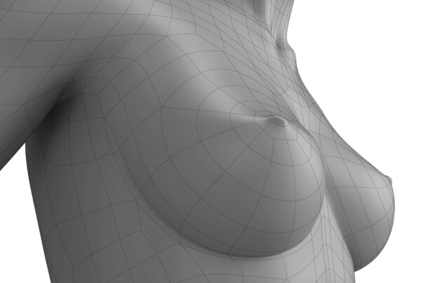 Breast-fat-grafting