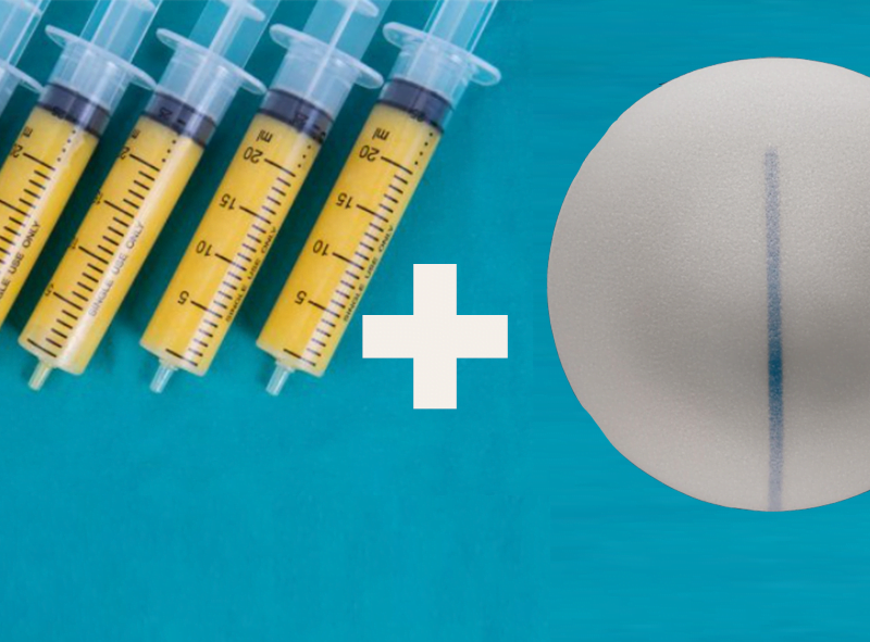 Breast-augmentation-Sydney