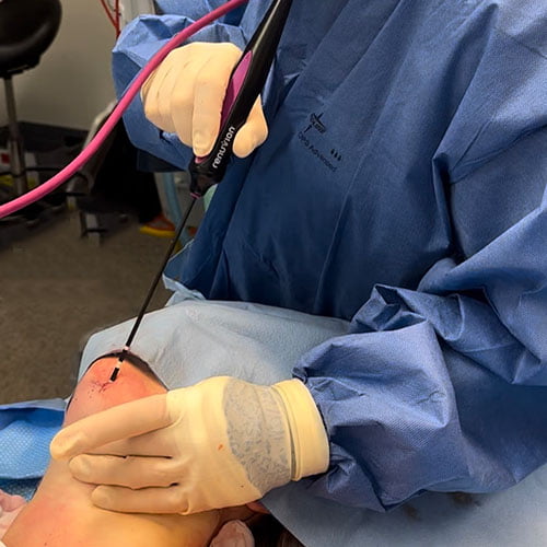 Non-surgical and minimally invasive options for the neck
